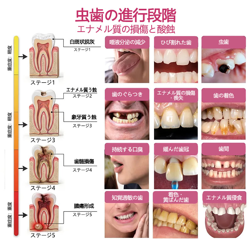 CleraNaure® DenPerm エナメル質修復フィリングジェル🦷🧡
