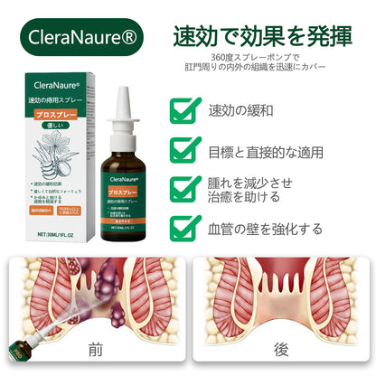 限定キャンペーン | CleraNaure® 速効性痔疾用PROスプレー🎁