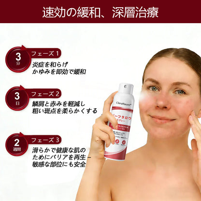 CleraNaure® ビーフタロウスプレー — かゆみ・皮膚の剥がれを抑える乾癬用スキンケアスプレー🥇