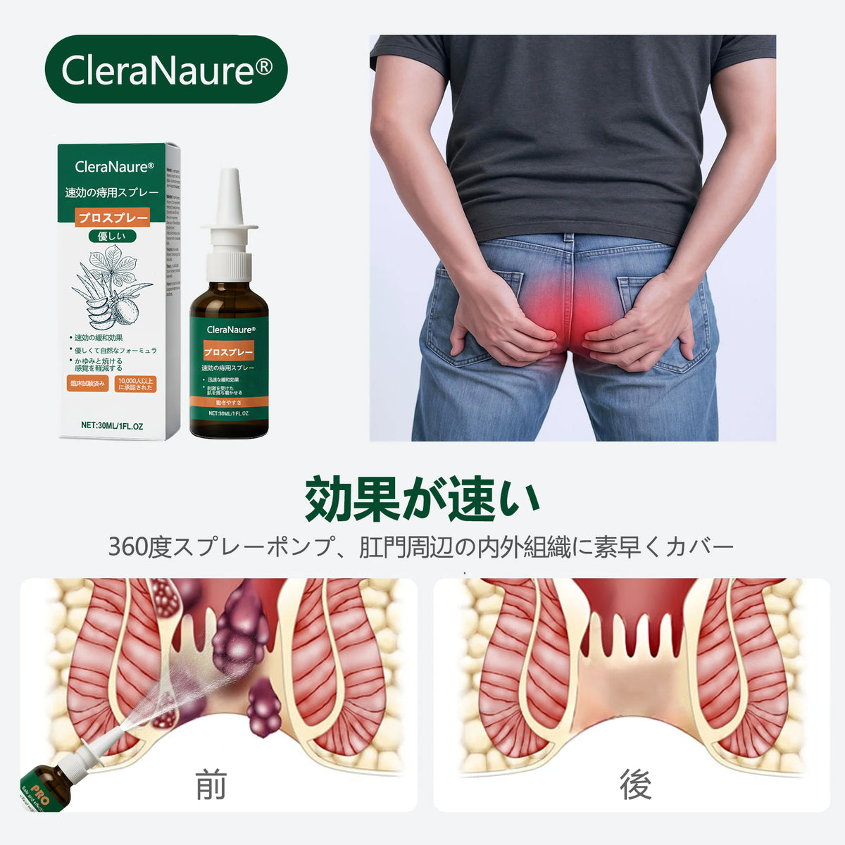 限定キャンペーン | CleraNaure® 速効性痔疾用PROスプレー🎁