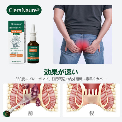 限定キャンペーン | CleraNaure® 速効性痔疾用PROスプレー🎁