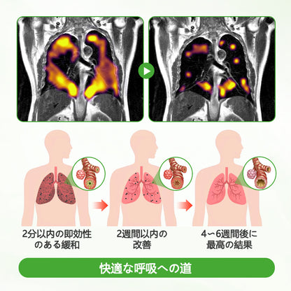 CleraNaure® HerbaAir マルリン肺浄化剤