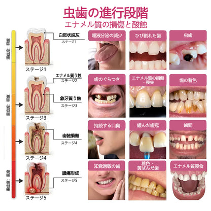 CleraNaure® DenPerm エナメル質修復フィリングジェル🦷🧡